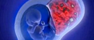 Беременность во время миомы матки