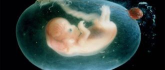 Гематома при беременности