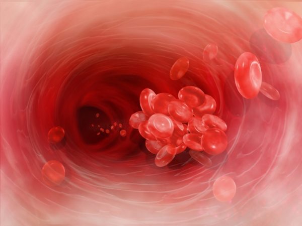 слипшиеся клетки крови