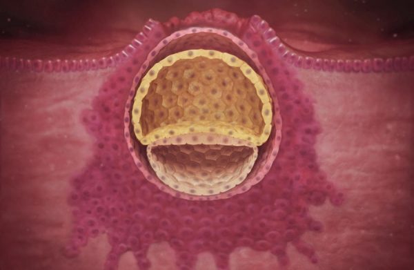 Имплантация эмбриона в матку