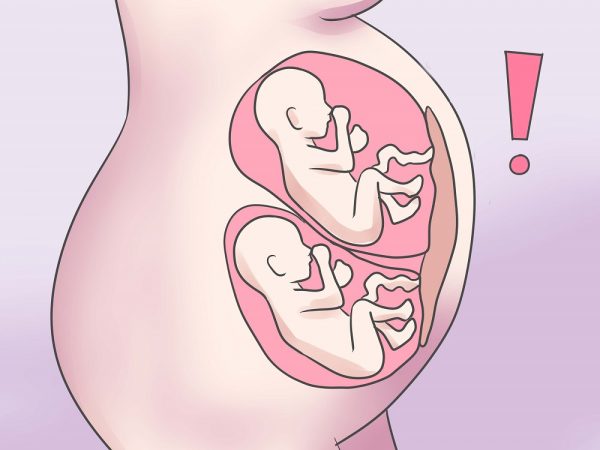 Многоплодная беременность на рисунке