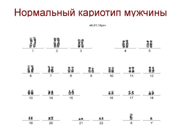 На фото — таблица с изображением хромосомного набора человека