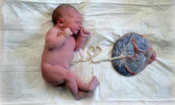 Новорожденный, соединённый пуповиной с плацентой