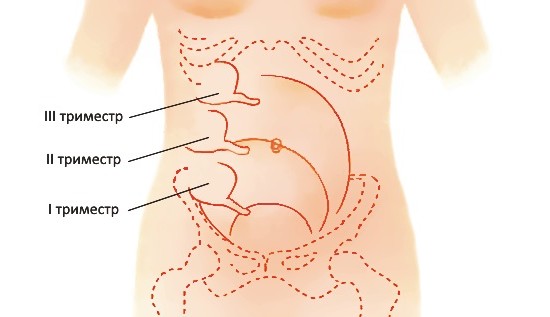 Схема расположения аппендикса на протяжении беременности