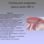 Гипоплазия плаценты
