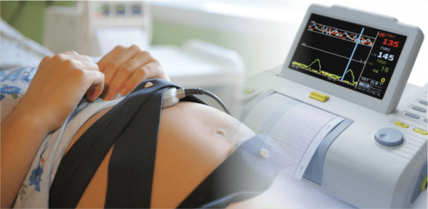 Процесс исследования сердцебиения малыша методом Кардиотокографии