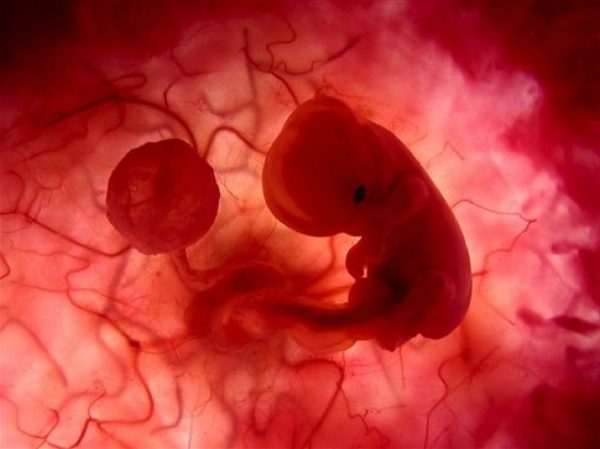 Эмбрион на ранних сроках беременности