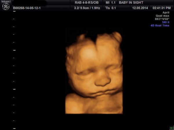 pregnant 41th week ultrasonography