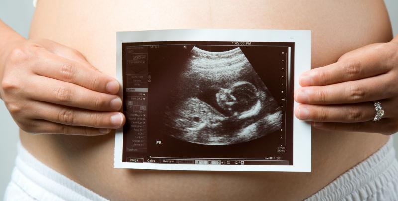 Снимок УЗИ на фоне живота беременной.
