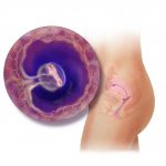 Изображение зародыша в организме женщины