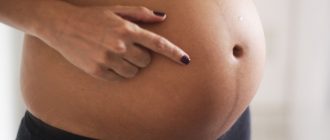 Тёмная полоска на животе