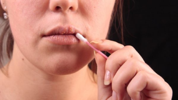 Женщина мажет губы кремом от герпеса