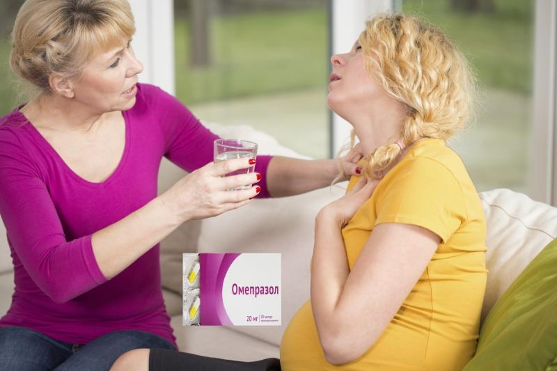 Омепразол — современный препарат от изжоги и повышенной кислотности при беременности