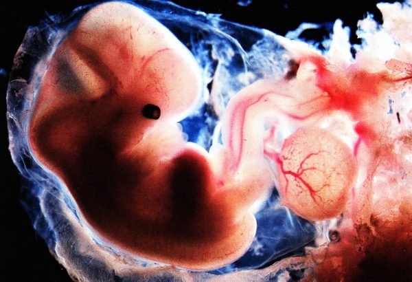 эмбрион в утробе