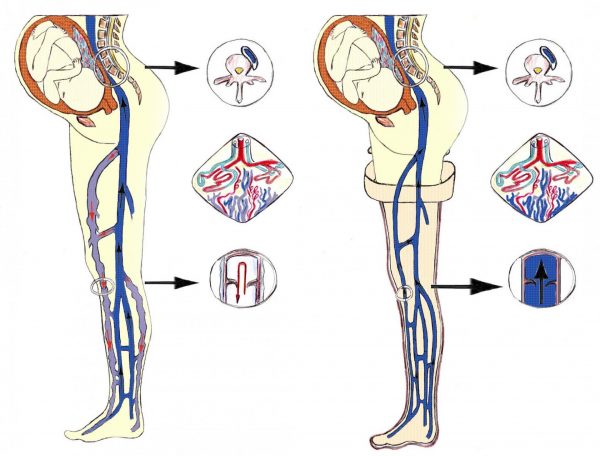 Кровеносная система у беременной женщины
