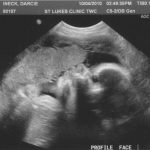Фотография малыша на 28 неделе беременности