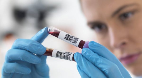 Лаборант рассматривает пробы крови