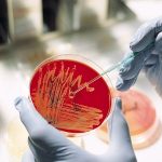 Медик проводит анализ на бактериальный посев