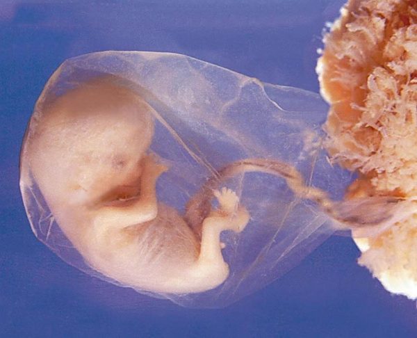 эмбрион прикрепился к слизистой матки