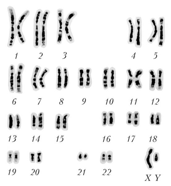 набор хромосом (кариотип) человека на схеме