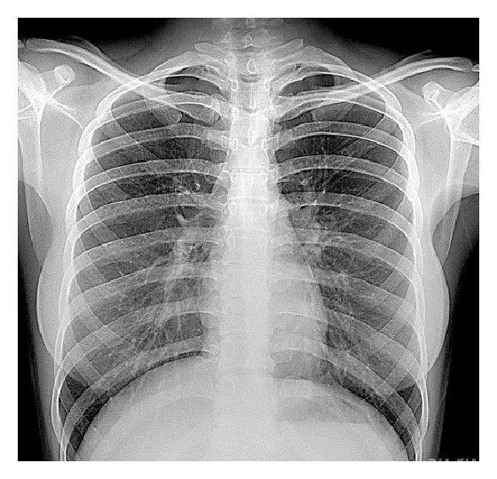 Рентгеновский снимок женской грудной клетки