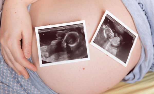 На животе у беременой женщин лежат 2 фото УЗИ