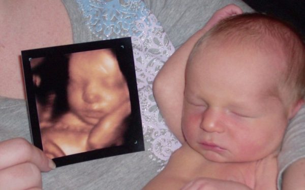 Изображение, полученное в результате 3D УЗИ, и новорождённый