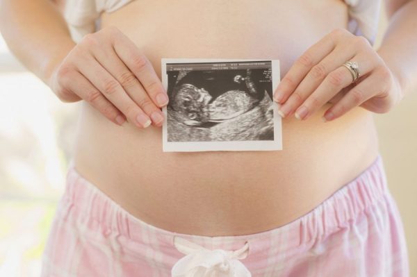 Беременная женщина держит в руках фото УЗИ малыша