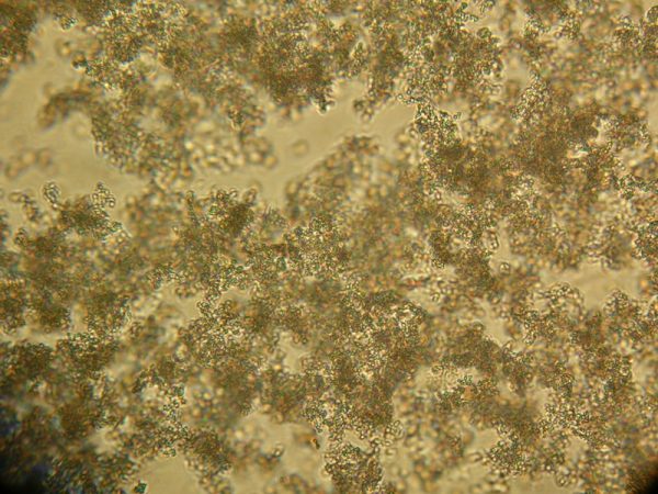 Кристаллы фосфатов в моче под микроскопом