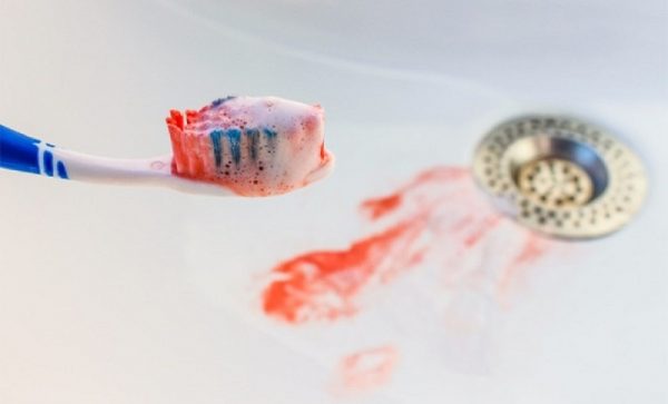 Кровь на зубной щётке и в раковине