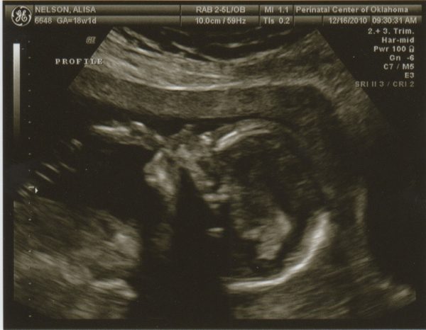 Снимок УЗИ на 7-м месяце беременности