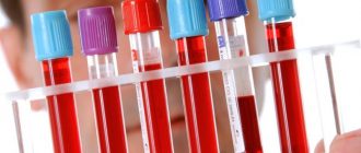 гематокрит