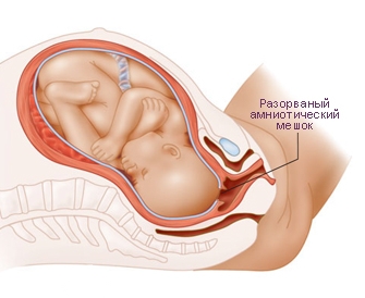 Положение плода в утробе на первом этапе родов