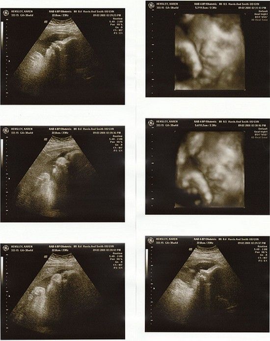 Малыш 39 недель беременности. УЗИ ребенка 39 неделя беременности. Фото УЗИ 39 недель беременности. УЗИ ребенка на 38 неделе беременности. УЗИ 37 недель беременности.