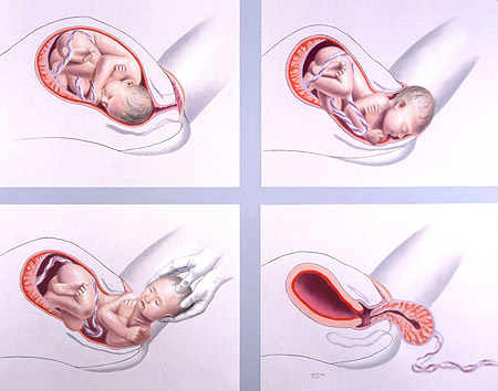 Этапы рождения ребёнка