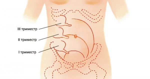 Расположение аппендикса в разные триместры беременности